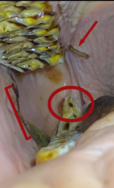 dental-pic